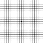 An Amsler Grid