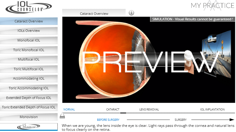 1765545999_ac3768e0b31348f797178c12ee8f5699 IOL Vision Simulation Tool