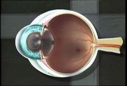 1765546927_Opening-the-bag Posterior Capsulotomy