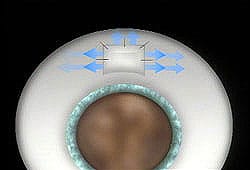 1765547040_gl16_sm Open-Angle Glaucoma