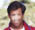 1765547101_Distorted-or-blurred-objects Macular Degeneration