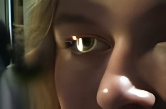 1765547410_Diagnosing-corneal-abrasions-2 Corneal Abrasions