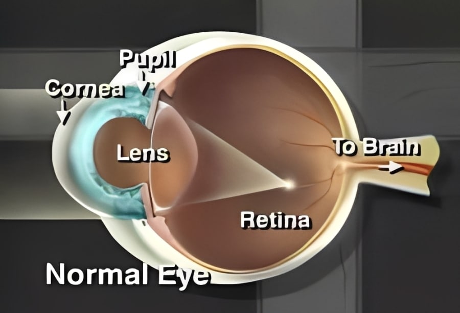 normal-eye-1 Corneal Ulcers